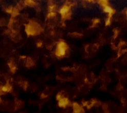 ACETATE
